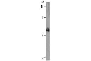 Gel: 10 % SDS-PAGE, Lysate: 40 μg, Lane: Human fetal muscle tissue, Primary antibody: ABIN7192404(SLC16A4 Antibody) at dilution 1/1200, Secondary antibody: Goat anti rabbit IgG at 1/8000 dilution, Exposure time: 10 minutes