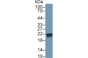 Western blot analysis of Cow Kidney lysate, using Rabbit Anti-Cow RBP4 Antibody (1 µg/ml) and HRP-conjugated Goat Anti-Rabbit antibody (abx400043, 0. (RBP4 Antikörper  (AA 19-201))