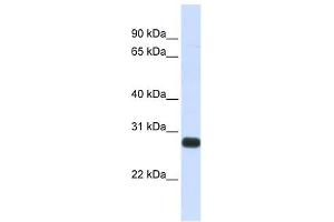 SPINT2 antibody used at 1 ug/ml to detect target protein. (SPINT2 Antikörper  (Middle Region))