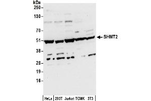 Western Blotting (WB) image for anti-serine Hydroxymethyltransferase 2 (Mitochondrial) (SHMT2) (AA 454-504) antibody (ABIN7450729)