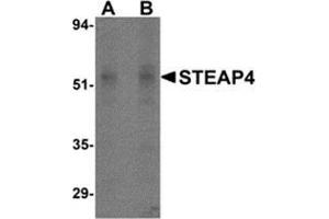 Western blot analysis of STEAP4 in rat liver tissue lysate with STEAP4 antibody at (A) 0. (STEAP4 Antikörper  (Center))