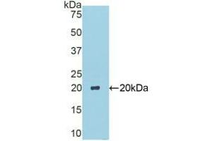 Western blot analysis of recombinant Mouse CA6. (CA6 Antikörper  (AA 27-181))