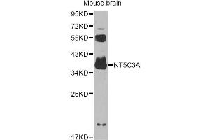 Western blot analysis of extracts of mouse brain, using NT5C3A antibody (ABIN6294220) at 1:1000 dilution. (NT5C3 Antikörper)
