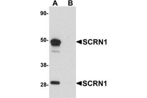 Western blot analysis of SCRN1 in human kidney tissue lysate with SCRN1 antibody at 1 μg/ml in (A) the absence and (B) the presence of blocking peptide. (Secernin 1 Antikörper  (C-Term))