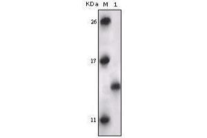 Western blot analysis using PRAK mouse mAb against truncated PRAK recombinant protein. (MAPKAP Kinase 5 Antikörper)