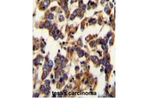 Immunohistochemistry (IHC) image for anti-Berardinelli-Seip Congenital Lipodystrophy 2 (Seipin) (BSCL2) antibody (ABIN2995527) (BSCL2 Antikörper)