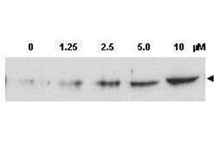 Western blot using  Affinity Purified anti-Chk2 pT68 antibody shows detection of a predominant band at ~60 kDa corresponding to phosphorylated Chk2 (arrowhead) in MCF-7 whole cell lysates after treatment with doxorubicin.