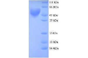 SDS-PAGE (SDS) image for Aryl Hydrocarbon Receptor Nuclear Translocator (ARNT) (AA 1-474), (partial) protein (His tag) (ABIN5713256) (ARNT Protein (AA 1-474, partial) (His tag))