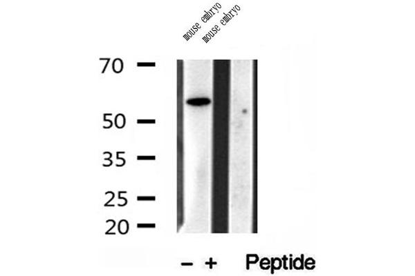 TCTN1 Antikörper  (N-Term)