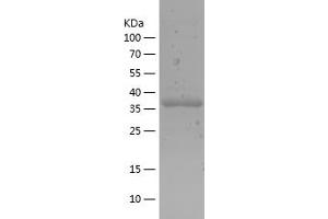 Western Blotting (WB) image for Ras Homolog Gene Family, Member Q (RHOQ) (AA 1-132) protein (His-IF2DI Tag) (ABIN7124788) (RHOQ Protein (AA 1-132) (His-IF2DI Tag))