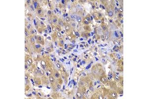 Immunohistochemistry (IHC) image for anti-Caspase Recruitment Domain Family, Member 10 (CARD10) (AA 863-1032) antibody (ABIN6137937)