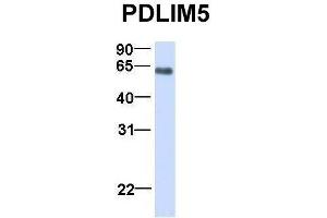 Western Blotting (WB) image for anti-PDZ and LIM Domain 5 (PDLIM5) (N-Term) antibody (ABIN2780775)