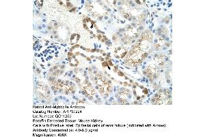 Mouse Lung (MYBBP1A Antikörper  (C-Term))