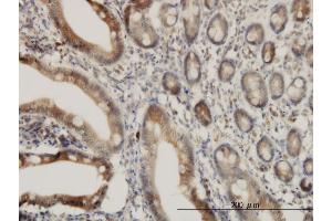 Immunoperoxidase of monoclonal antibody to ADAM17 on formalin-fixed paraffin-embedded human small Intestine.