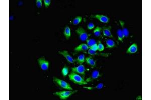 Immunofluorescent analysis of A549 cells using ABIN7149470 at dilution of 1:100 and Alexa Fluor 488-congugated AffiniPure Goat Anti-Rabbit IgG(H+L) (DRD5 Antikörper  (AA 361-477))