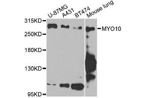 Western blot analysis of extracts of various cell lines, using MYO10 antibody. (Myosin X Antikörper  (AA 845-944))