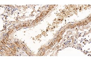 Detection of CNN1 in Human Lung Tissue using Polyclonal Antibody to Calponin 1, Basic (CNN1) (CNN1 Antikörper  (AA 1-268))