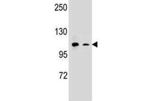 Western Blotting (WB) image for anti-Integrin alpha M (ITGAM) (AA 253-282) antibody (ABIN3031364)