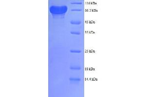 Phosphogluconate Dehydrogenase (PGD) (AA 4-483), (partial) protein (GST tag)