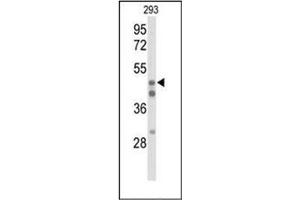 Western Blotting (WB) image for anti-Hepatocyte Nuclear Factor 4, alpha (HNF4A) (AA 116-145), (N-Term) antibody (ABIN952766)