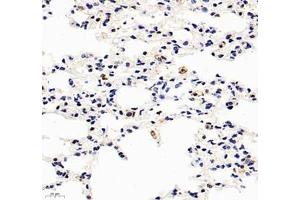 Immunohistochemistry of paraffin embedded mouse lung using HSP70B (ABIN7074173) at dilution of 1: 1000 (400x lens) (HSPA6 Antikörper)
