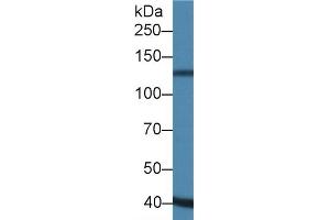 Detection of ADAMTS19 in Porcine Heart lysate using Polyclonal Antibody to A Disintegrin And Metalloproteinase With Thrombospondin 19 (ADAMTS19) (ADAMTS19 Antikörper  (AA 325-686))