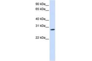 Image no. 1 for anti-Kv Channel Interacting Protein 4 (KCNIP4) (N-Term) antibody (ABIN6742500) (KCNIP4 Antikörper  (N-Term))