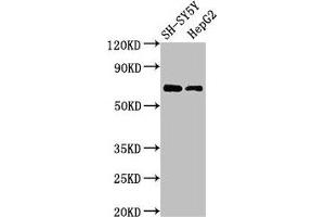 Western Blot Positive WB detected in: SH-SY5Y whole cell lysate, HepG2 whole cell lysate All lanes: C7orf31 antibody at 2. (C7orf31 Antikörper  (AA 163-256))