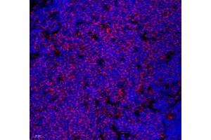 Immunofluorescence of paraffin embedded mouse thymus using Lat (ABIN7074502) at dilution of 1: 2100 (400x lens) (LAT Antikörper)