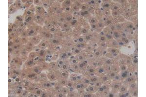 IHC-P analysis of Mouse Liver Tissue, with DAB staining. (SIRT3 Antikörper  (AA 5-257))