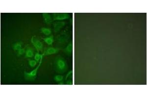 Immunofluorescence analysis of A549 cells, using TIMP2 Antibody. (TIMP2 Antikörper  (AA 21-70))