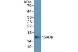 Western Blotting (WB) image for Procollagen I N-Terminal Propeptide (PINP) ELISA Kit (ABIN6574243)