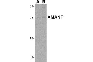 Western Blotting (WB) image for anti-Mesencephalic Astrocyte-Derived Neurotrophic Factor (MANF) (N-Term) antibody (ABIN1031449) (MANF Antikörper  (N-Term))