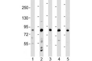 Western blot testing of human 1) HeLa, 2) HL-60, 3) THP-1, 4) CCRF-CEM and 5) SH-SY5Y cell lysate with LRCH4 antibody at 1:2000.
