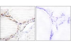 Immunohistochemistry analysis of paraffin-embedded human thyroid gland tissue, using Vitamin D Receptor (Ab-208) Antibody.