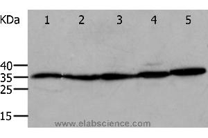 Western blot analysis of Mouse eyes and heart, Human cervical cancer tissue, OP9 and RAW264. (Annexin V Antikörper)