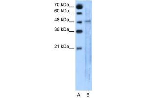 SLC25A46 antibody used at 5 ug/ml to detect target protein. (SLC25A46 Antikörper  (N-Term))