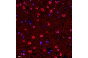 Immunofluorescence of paraffin embedded rat brain using SUV39H1 (ABIN7075770) at dilution of 1:1000 (400x lens) (SUV39H1 Antikörper)