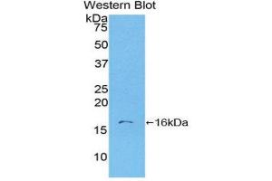 Western Blotting (WB) image for anti-S100 Calcium Binding Protein A6 (S100A6) (AA 1-90) antibody (ABIN3201618) (S100A6 Antikörper  (AA 1-90))