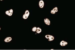 Image no. 2 for anti-Protein Phosphatase 1, Regulatory (Inhibitor) Subunit 10 (PPP1R10) (AA 605-716) antibody (ABIN968349)