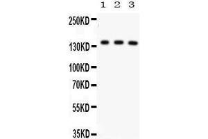 Anti- ABCB11 Picoband antibody, Western blotting All lanes: Anti ABCB11  at 0. (ABCB11 Antikörper  (C-Term))