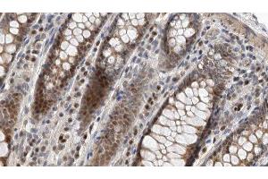 ABIN6275170 at 1/100 staining Rat colon tissue by IHC-P. (GIMAP5 Antikörper  (Internal Region))