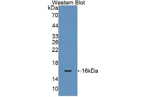 Detection of Recombinant CD7, Human using Polyclonal Antibody to Cluster Of Differentiation 7 (CD7) (CD7 Antikörper  (AA 26-134))