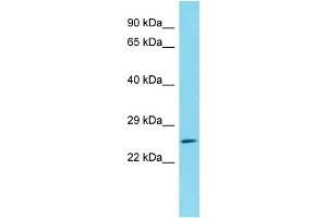 Host: Rabbit Target Name: C1orf105 Sample Type: HepG2 Whole Cell lysates Antibody Dilution: 1. (C1ORF105 Antikörper  (N-Term))