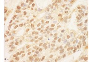 Immunohistochemistry (IHC) image for anti-Zinc Finger E-Box Binding Homeobox 2 (ZEB2) (AA 750-800) antibody (ABIN7454452)