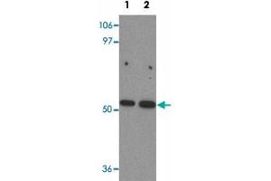 Western blot analysis of BANP in mouse kidney tissue lysate with BANP polyclonal antibody  at (1) 1 and (2) 2 ug/mL. (BANP Antikörper  (Internal Region))
