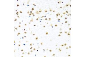Immunohistochemistry of paraffin-embedded mouse brain using RAB3IP antibody at dilution of 1:100 (x40 lens). (RAB3IP Antikörper)