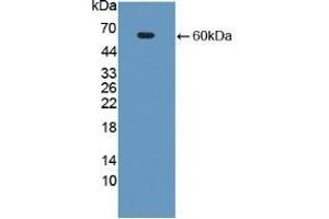 Detection of Recombinant CECR1, Human using Polyclonal Antibody to Cat Eye Syndrome Chromosome Region, Candidate 1 (CECR1) (CECR1 Antikörper  (AA 30-511))