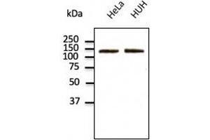 Endogenous CDH2 detected with at 1/500 dilution; lysates at 100 µg per lane and rabbit polyclonal to goat lgG (HRP) at 1/10,000 dilution. (N-Cadherin Antikörper  (C-Term))