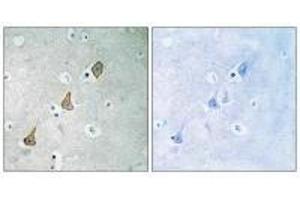 Immunohistochemistry analysis of paraffin-embedded human brain tissue using PECAM-1 (Ab-713) antibody. (CD31 Antikörper  (Tyr713))